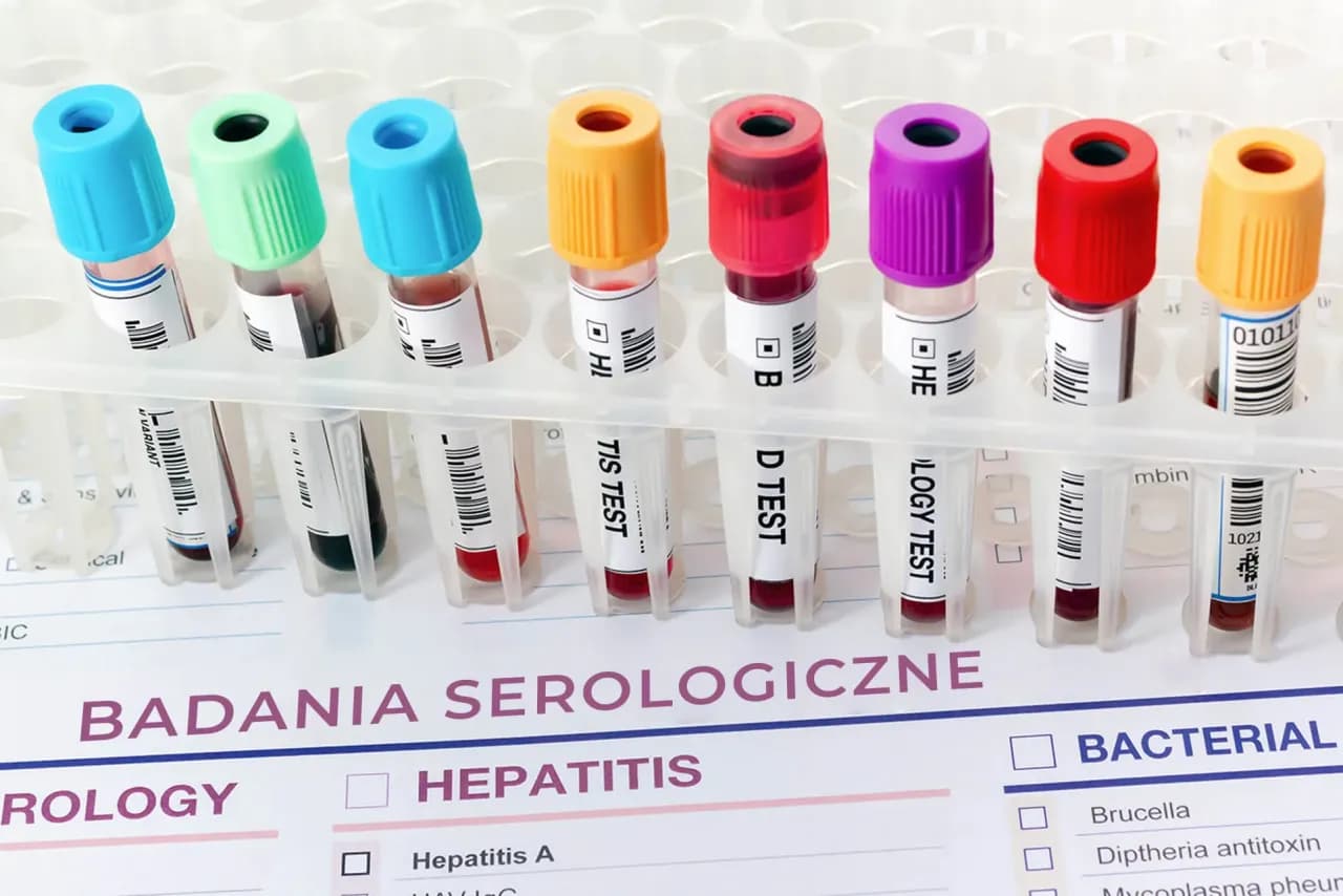 Badania serologiczne – co to jest i jakie mają zastosowanie w diagnostyce Badania serologiczne – co to jest i jakie mają zastosowanie w diagnostyce
