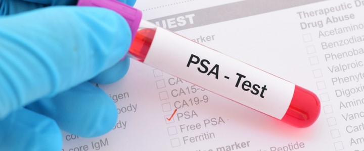Badanie PSA i jego znaczenie dla zdrowia mężczyzny